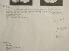 25岁女子怀上9胞胎，医生：可能与这两点有关