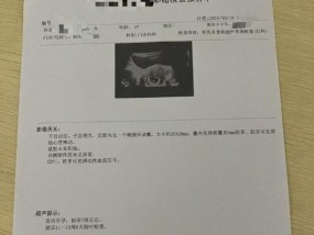 哺乳期女子称被介绍到成都做代孕怀上孩子遭机构拉黑已终止妊娠回家